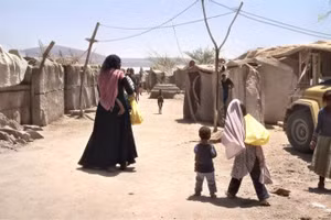 Yemen hiện đang phải vật lộn với nạn đói và suy dinh dưỡng. (Ảnh: UNWFP)