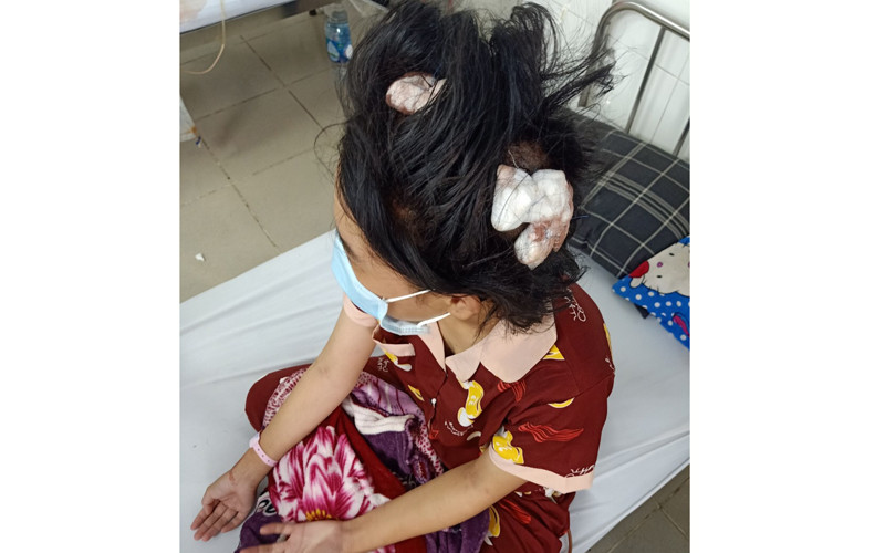 Nạn nhân bị "cha dượng" đánh đập dã man phải vào bệnh viện cấp cứu.