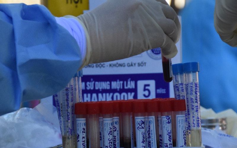 Đà Nẵng có ca tái dương tính với virus SARS-CoV-2 sau 18 ngày xuất viện. (Ảnh minh họa)