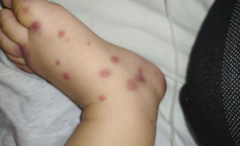 Bệnh nhi mắc căn bệnh cực hiếm trong y văn thế giới. 