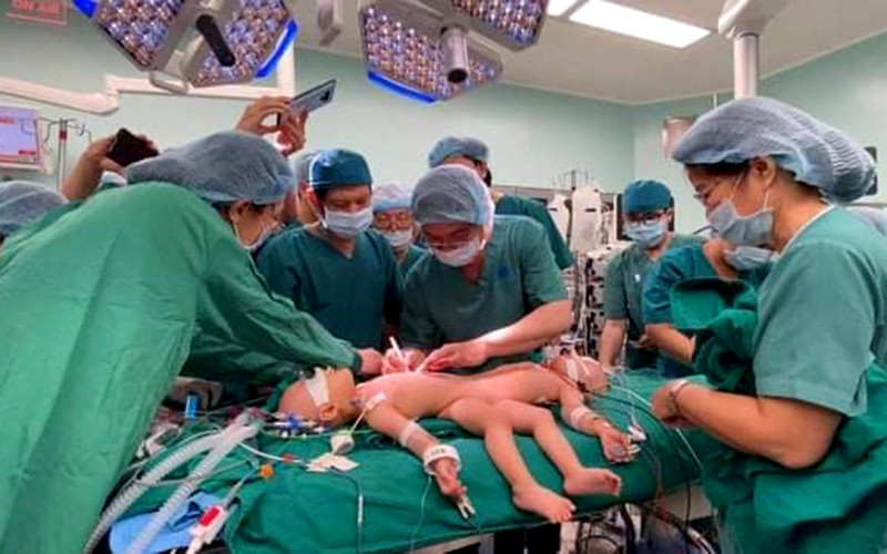 Các bác sĩ bắt đầu cuộc mổ tách dính cặp song sinh Trúc Nhi - Diệu Nhi. 