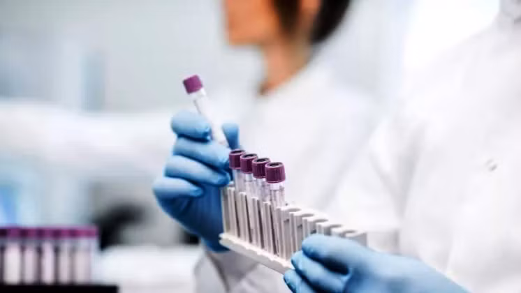 Xét nghiệm Covid-19 từ mẫu nước bọt rẻ hơn và ít xâm lấn. Ảnh: Shutterstock.