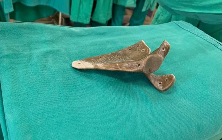 Bả vai làm bằng vật liệu sinh học. 