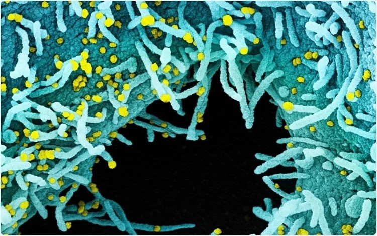 Ảnh: NIAID / Flickr.