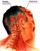 Các bệnh đau đầu thường gặp và cách phòng trị