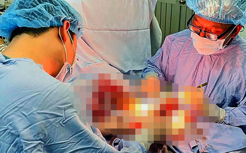 Ê-kíp tiến hành phẫu thuật hơn 5 giờ nối lại bàn tay đứt rời cho bệnh nhân.