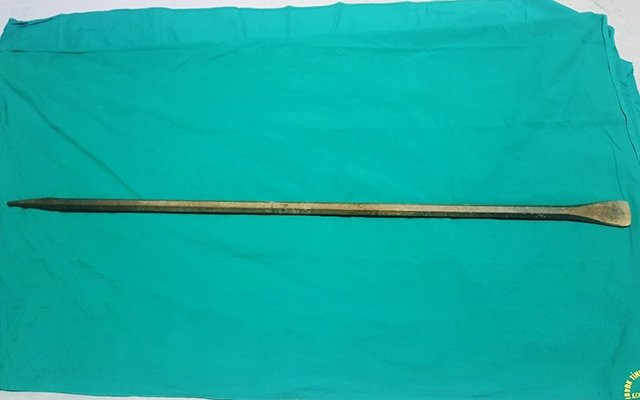 Chiếc xà-beng đã được tách khỏi người bệnh
