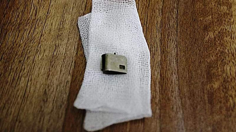 Nắp bật lửa được lấy ra từ bụng bé D.K.N.