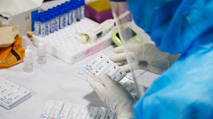 Xét nghiệm nhanh Covid-19. Ảnh: KHIẾU MINH