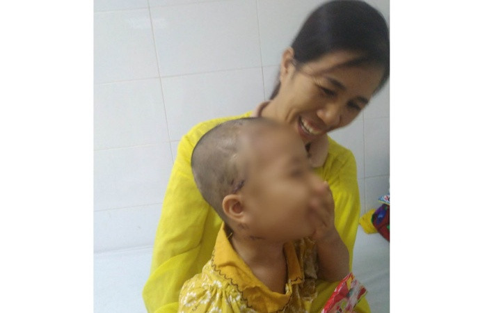 Người thân chăm sóc trẻ sau can thiệp y tế.