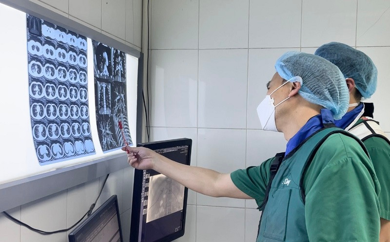 Các bác sĩ khoa Chẩn đoán hình ảnh hội chẩn trước can thiệp cho bệnh nhân.