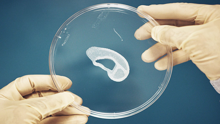 Cấy ghép tai in 3D