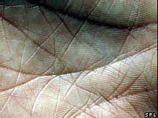 Bàn tay con người chứa nhiều vi khuẩn
(ảnh: BBC).