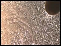 Người tách thành công tế bào gốc từ màng dây rốn