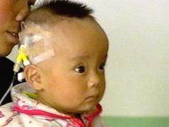 Một em bé là nạn nhân
của sữa nhiễm melamine.