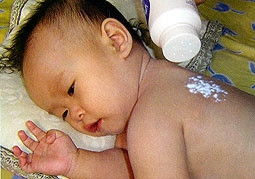 Trị rôm để da không nhiễm trùng