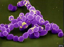 Phát hiện phương thức vi khuẩn đường ruột gây bệnh ung thư