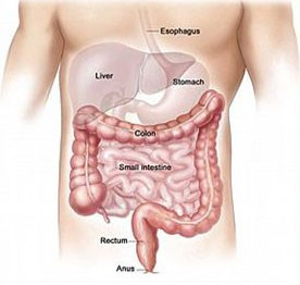 Phát hiện một biến thể gene liên quan bệnh ung thư đại tràng