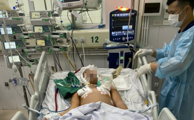 Bệnh nhi có 41 ngày phải can thiệp ECMO.