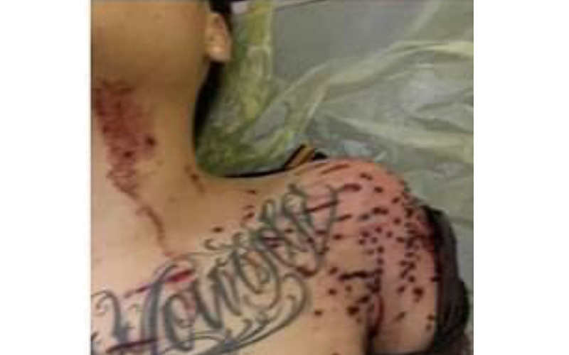 Nạn nhân Hoàng bất tỉnh ngay khi bị hàng chục vết đạn găm vào người.