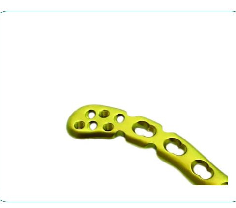 Nẹp dùng cho phẫu thuật chấn thương chỉnh hình Arsenio