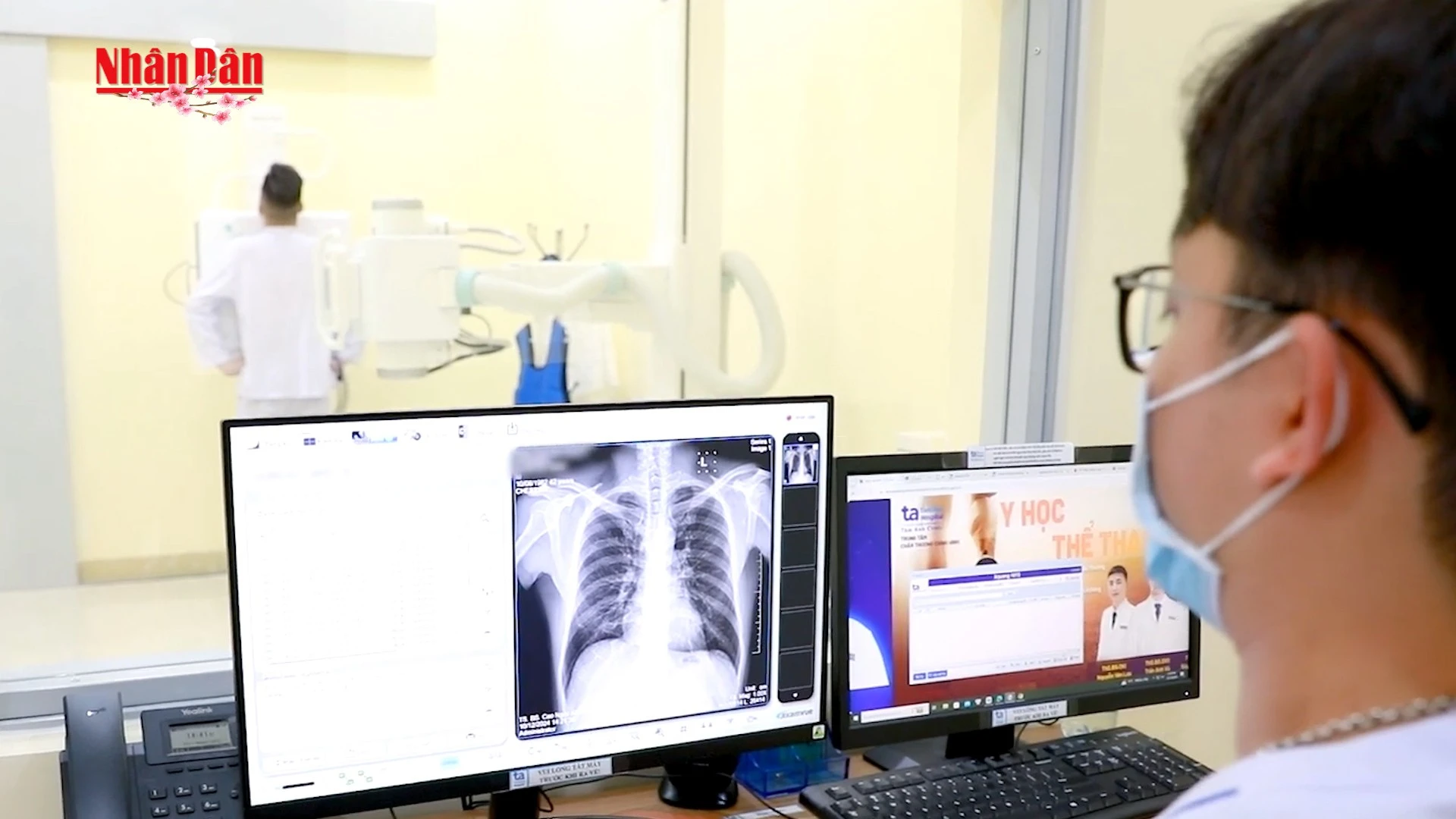 Bệnh nhân phản đối việc BHYT từ chối chi trả vì thời gian chụp X-quang quá nhanh