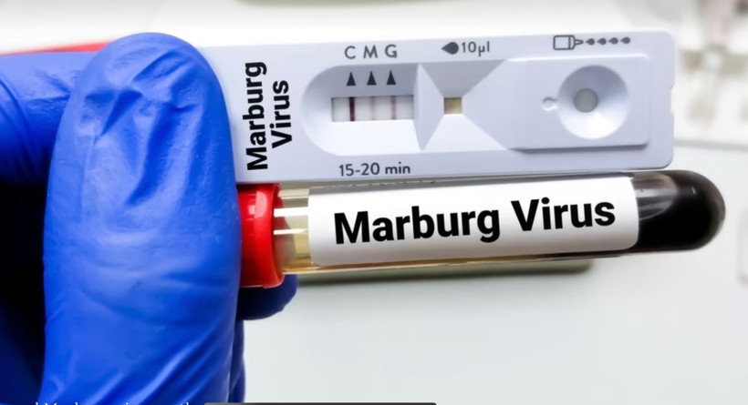 Ống xét nghiệm virus Marburg. Ảnh: Tân Hoa xã