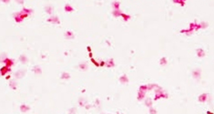 Vi khuẩn Klebsiella oxytoca. Ảnh: PO