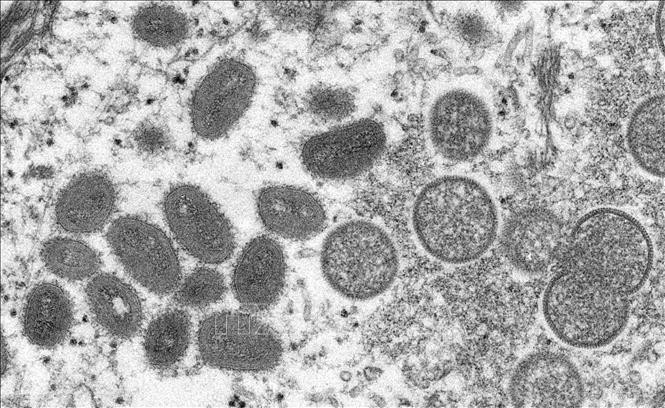 Hình ảnh virus đậu mùa khỉ dưới kính hiển vi. (Ảnh: AFP/TTXVN)