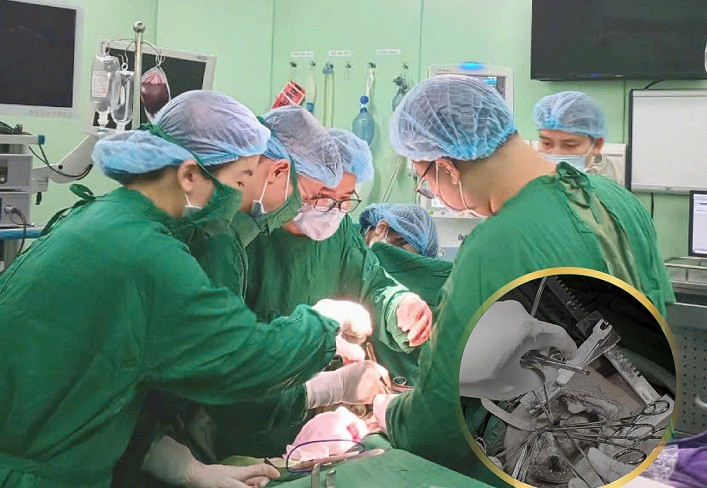 Kíp cấp cứu phẫu thuật cứu sống người bệnh. (Ảnh: Từ Thành)