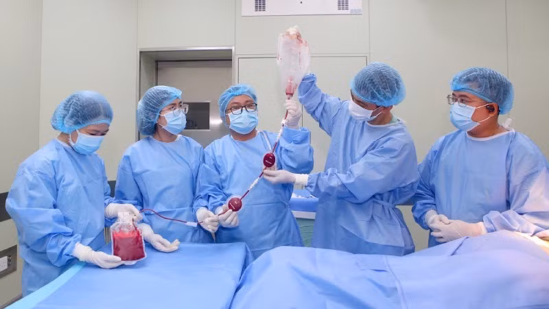 Ca ghép được thực hiện dưới sự hỗ trợ của chuyên gia trong và ngoài nước. (Ảnh: Bệnh viện Trung ương Huế cung cấp)