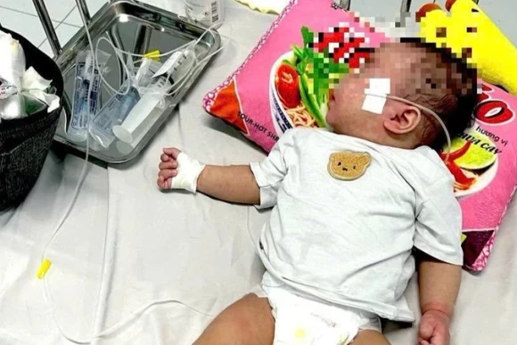 Bệnh sởi diễn biến phức tạp tại TP Hồ Chí Minh.