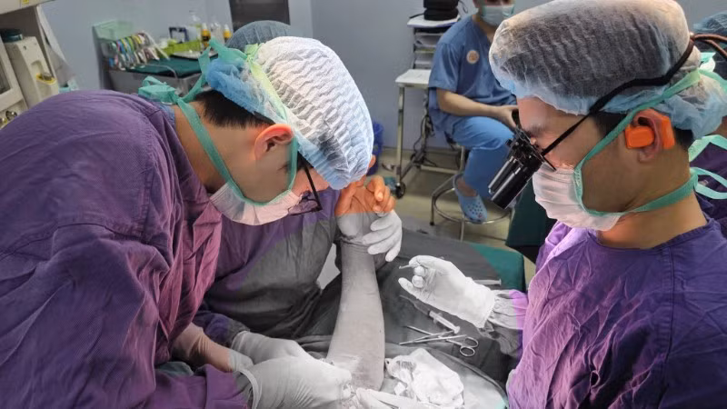 Bác sĩ tiến hành phẫu thuật trồng lại cánh tay đứt rời cho người bệnh. 