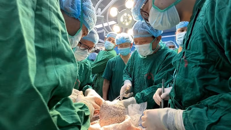 Các thầy thuốc thực hiện ca ghép phổi cuối năm. 