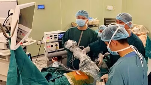 Tiến sĩ, bác sĩ Ngô Gia Khánh và Thạc sĩ, bác sĩ Đồng Minh Hùng, Khoa Phẫu thuật Lồng ngực và Mạch máu, Bệnh viện Bạch Mai tiến hành mổ nội soi dưới mũi ức cắt kén khí phổi hai bên cho người bệnh.
