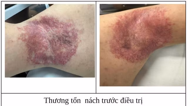 tonthuong-7045.jpg