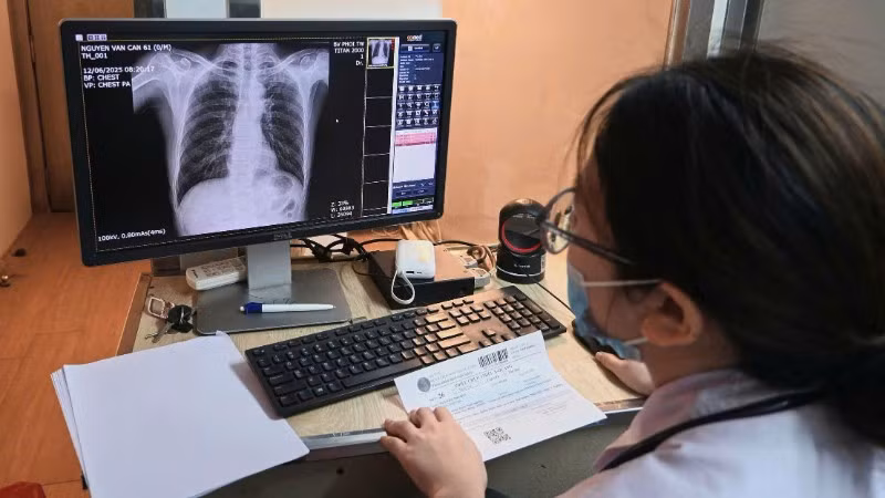 Chụp X-quang phổi sàng lọc bệnh lao. 