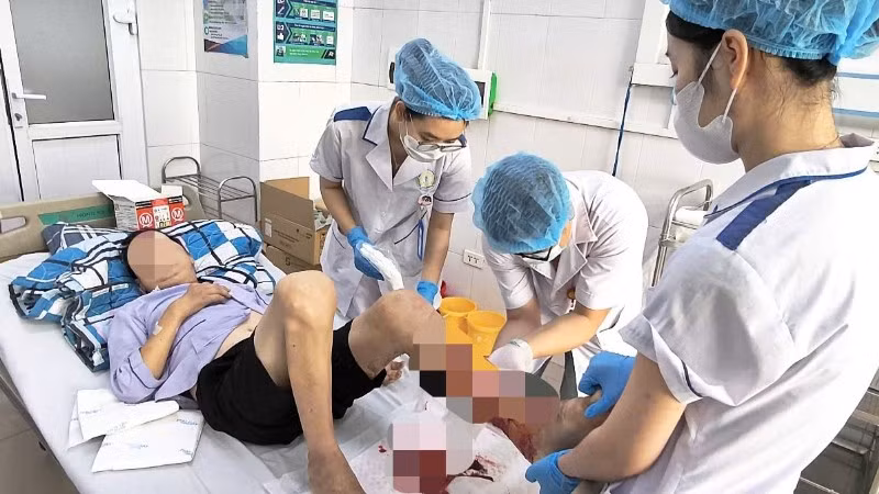 Thời gian gần đây, Bệnh viện Bệnh Nhiệt đới Trung ương liên tục tiếp nhận các ca viêm mô bào hoại tử chi trong tình trạng nguy kịch.