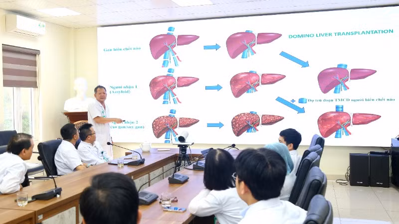 Phó Giáo sư, Tiến sĩ Dương Đức Hùng, Giám đốc Bệnh viện Hữu nghị Việt Đức cùng các bác sĩ hội chẩn trường hợp ghép tạng domino đặc biệt. 