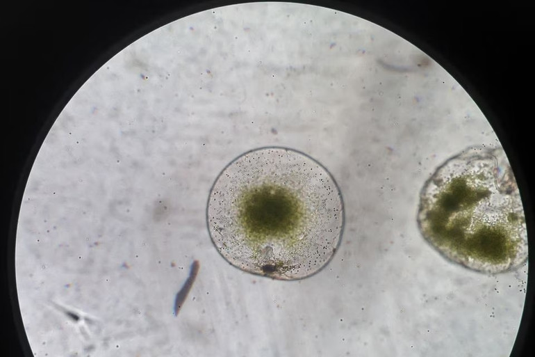 Tảo biển Noctiluca Scintillans được quan sát qua kính hiển vi. Ảnh: Reuters.