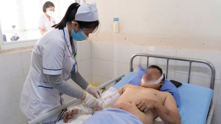Công nhân bị bỏng trong vụ nổ đang được chăm sóc, điều trị, xử lý vết thương tại khoa Ngoại chấn thương, Bệnh viện Đa khoa Trung ương Quảng Nam.