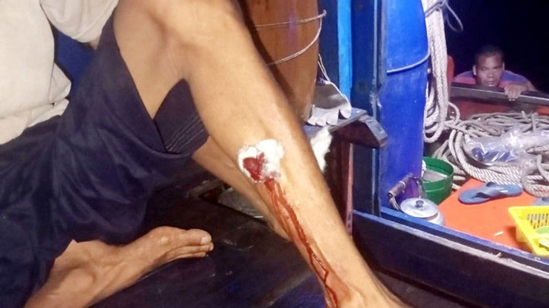 Chân của một ngư dân bị thương tích. (Ảnh: Ngư dân cung cấp)