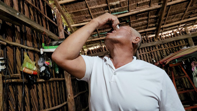 Anh Việt rửa vết thương trên khuôn mặt và mắt do bị cá cắn.