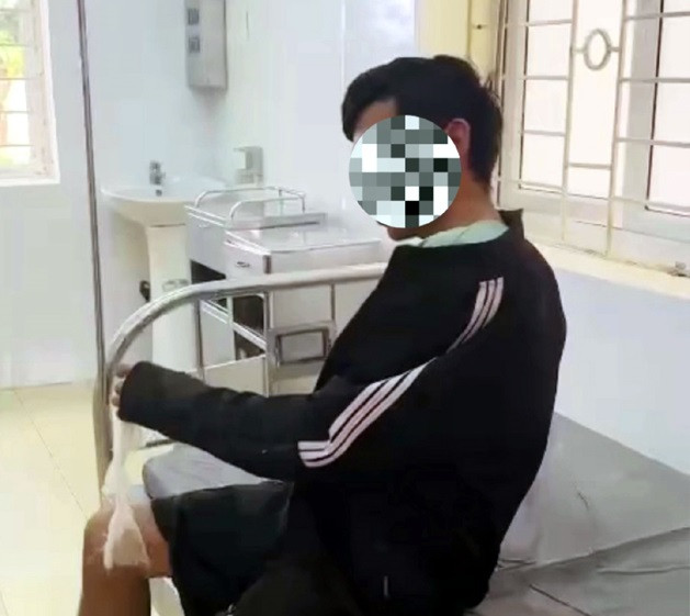 Một trường hợp ở huyện Mường Chà (tỉnh Điện Biên) bị phát bệnh dại do bị chó cắn. (Ảnh C.T.V.)