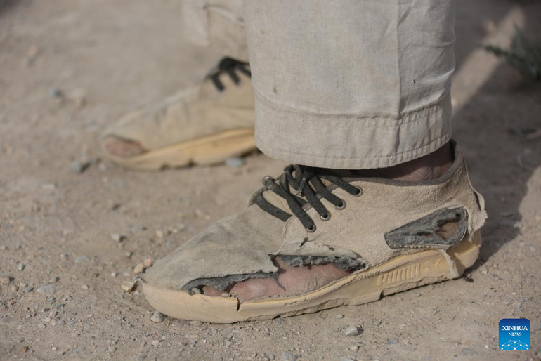 Đôi giày của một lao động tại một lò gạch ở Kabul, thủ đô Afghanistan, ngày 29/4/2025. (Ảnh: Tân Hoa xã) Đôi giày của một lao động tại một lò gạch ở Kabul, thủ đô Afghanistan, ngày 29/4/2025. (Ảnh: Tân Hoa xã)