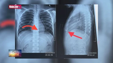 Cảnh báo tai nạn nguy hiểm từ tự chế pháo nổ