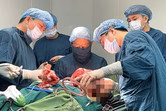 Các bác sĩ thực hiện ca phẫu thuật cho người bệnh trong 8 tiếng đồng hồ và truyền tới 49 đơn vị máu.