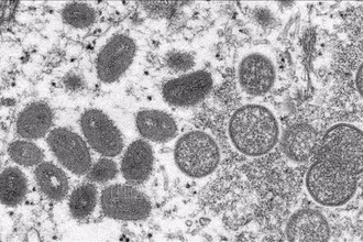 Hình ảnh virus đậu mùa khỉ dưới kính hiển vi điện tử. (Ảnh: AFP/TTXVN) 