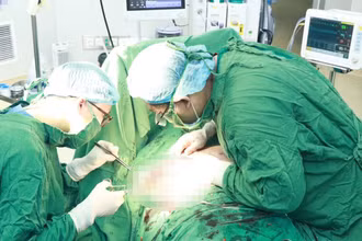 Các bác sĩ phẫu thuật loại bỏ khối u vú cho bệnh nhân. 