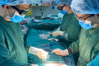 Các bác sĩ phẫu thuật loại bỏ khối u gan cho bệnh nhân. 